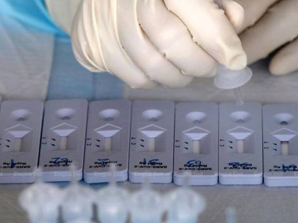 Anak syarikat Hong Seng peroleh kontrak bekal kit ujian PCR bernilai RM112.32 juta